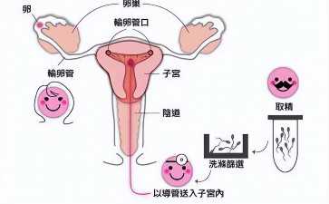 国内可以供卵的医院,肇庆三代试管私立医院靠谱吗