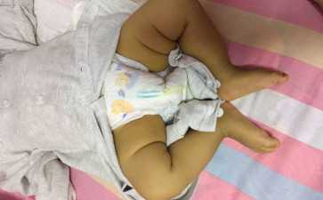 卵巢颗粒细胞瘤是癌吗--正规代妈要求