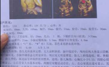 国内供卵医院排名榜单,高龄女性做试管婴儿费用多少？费用5万够吗？