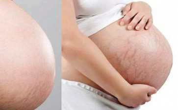 国内哪家医院有供卵库的,哪些妇科病会导致女性不孕不育？