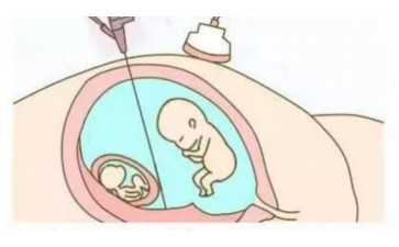 国内有几家代孕机构,甘肃试管婴儿做一次多少钱？甘肃试管婴儿怎么样？