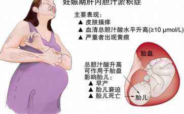 国内代怀儿子套餐,高龄女性做试管婴儿的注意事项有哪些？