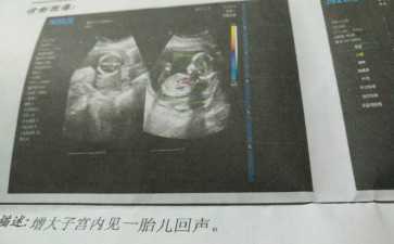 国内私立供卵中心,输卵管不通该怎么办？