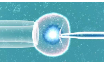 国内代怀包男孩,男方的检查项目(乌克兰做试管婴儿夫妻双方需要检查的项目)