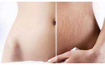 国内代怀机构哪家,做试管婴儿的年龄多少合适？高龄试管*率多少